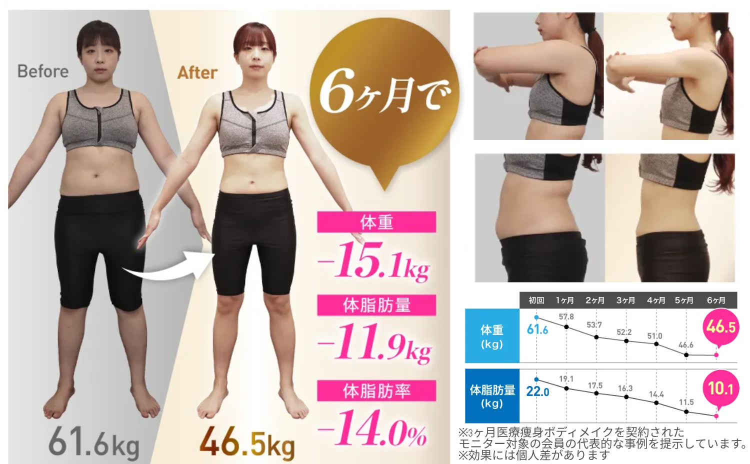 医療ダイエットのビフォーアフター